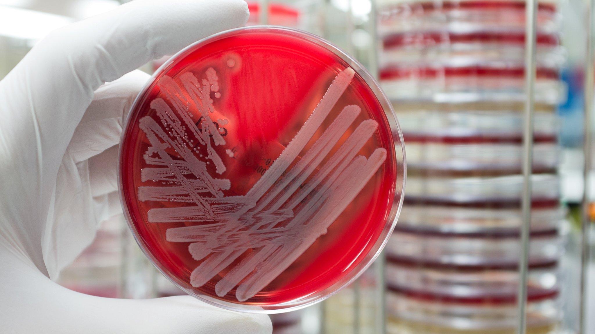 Bacteria growing on a plate