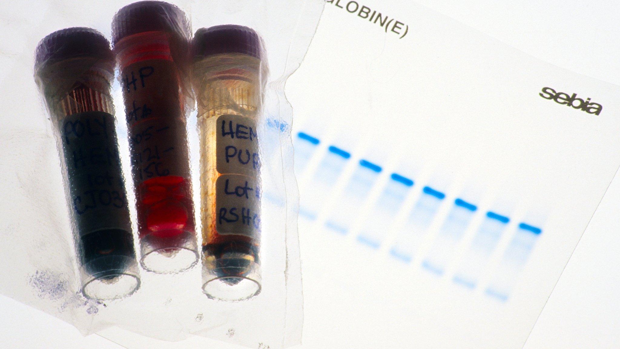 Samples at an anti-doping laboratory