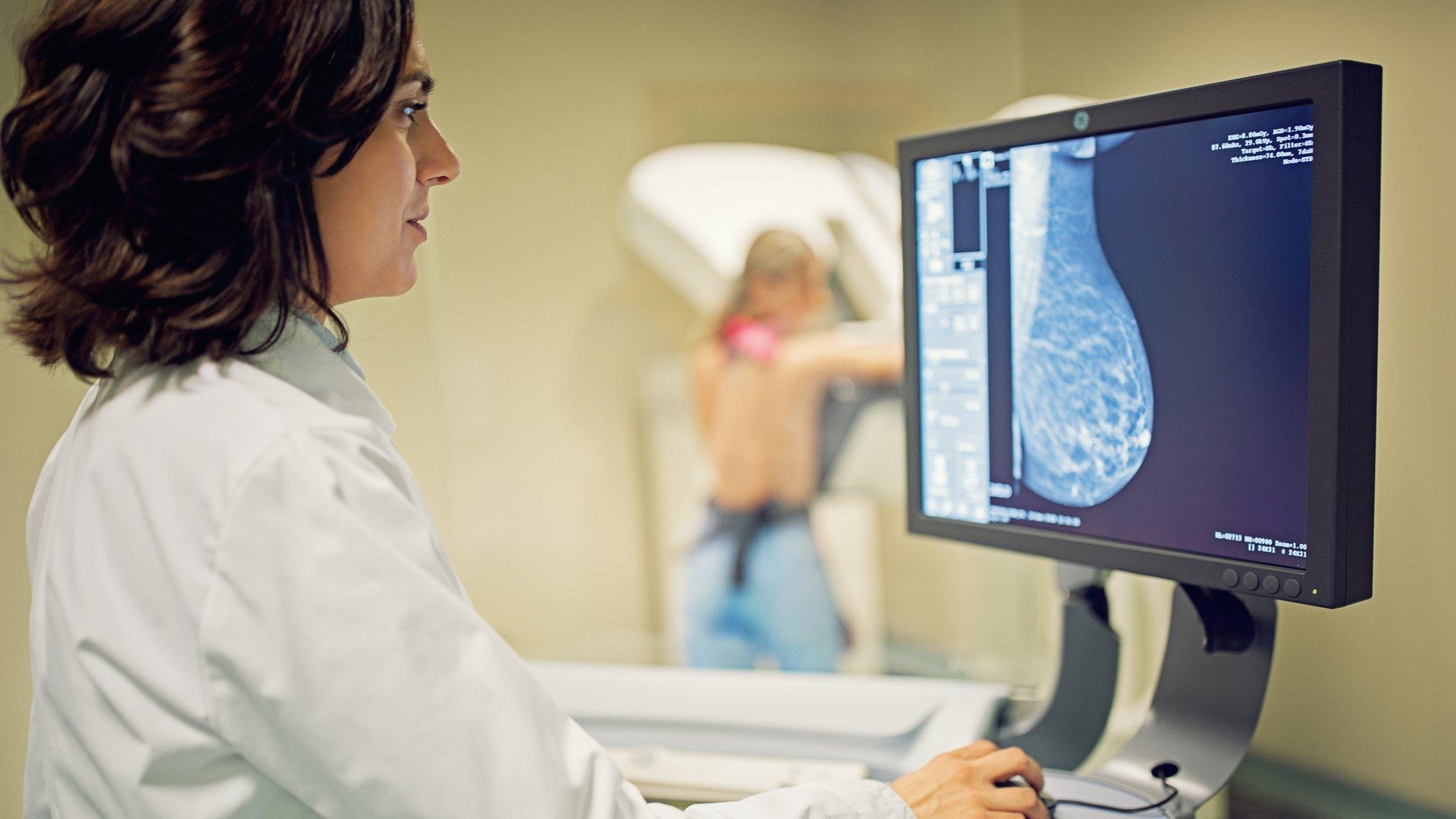 Mammogram