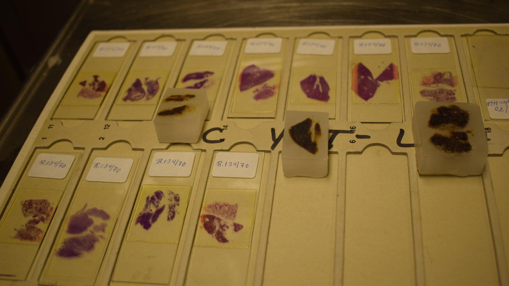 Glass slides and paraffin blocks containing tissue samples from the Isdal Woman's organs