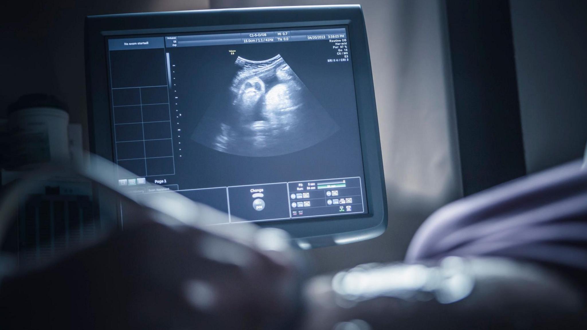 A picture of a foetal scanning machine in a hospital