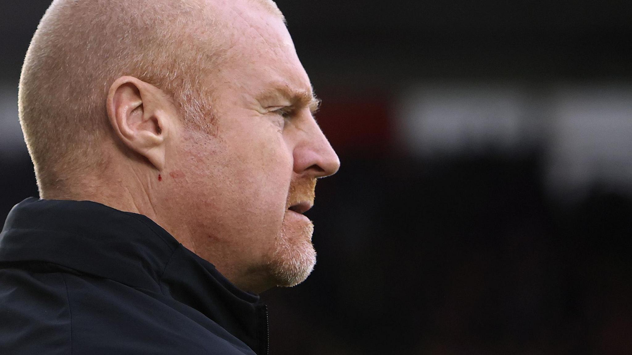 Sean Dyche looks on from the touchline