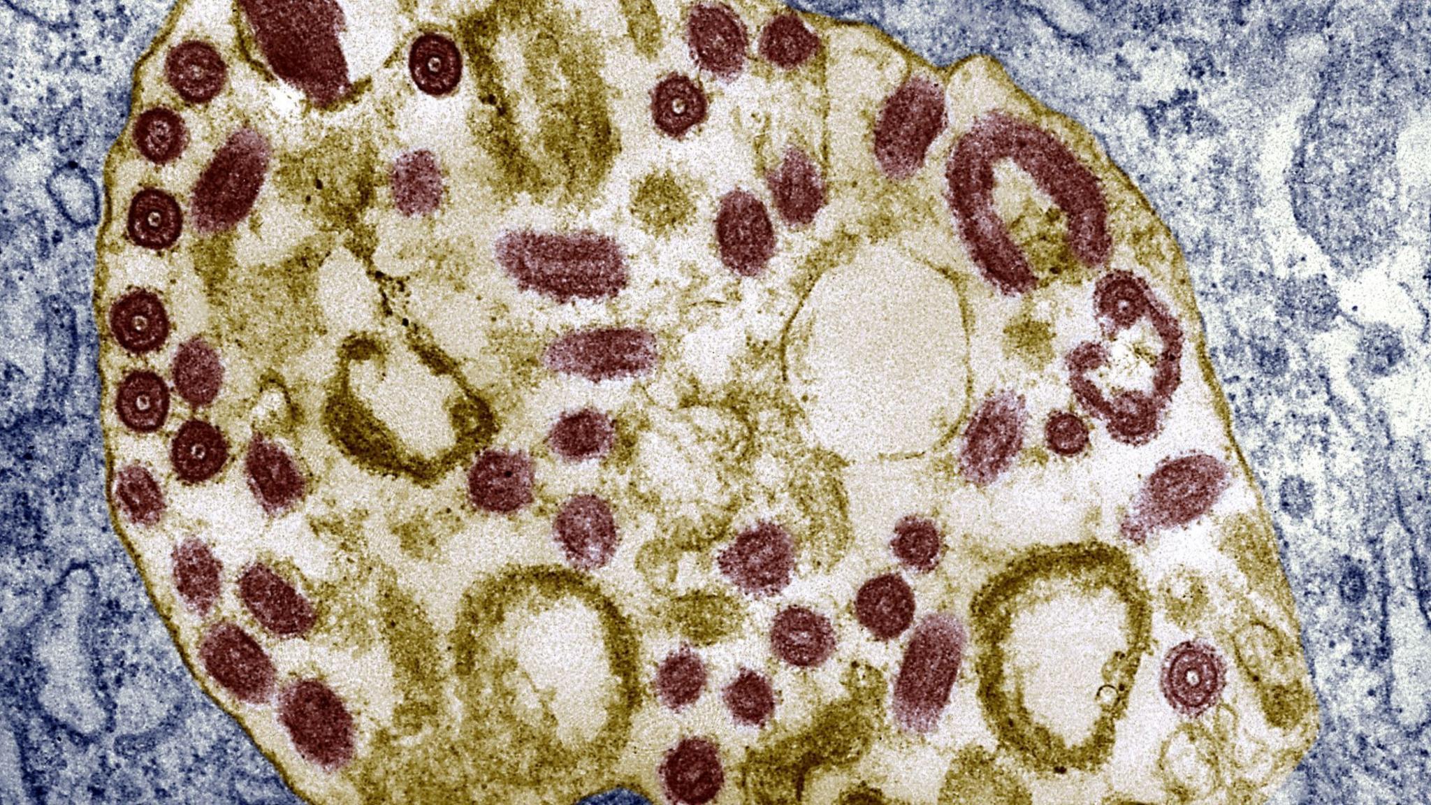 Electron Micrograph Of The Marburg Virus