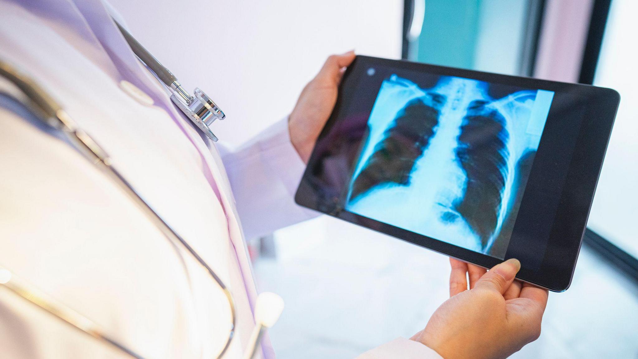 Library image of a doctor in a white gown looking at a lung scan on a handheld device.