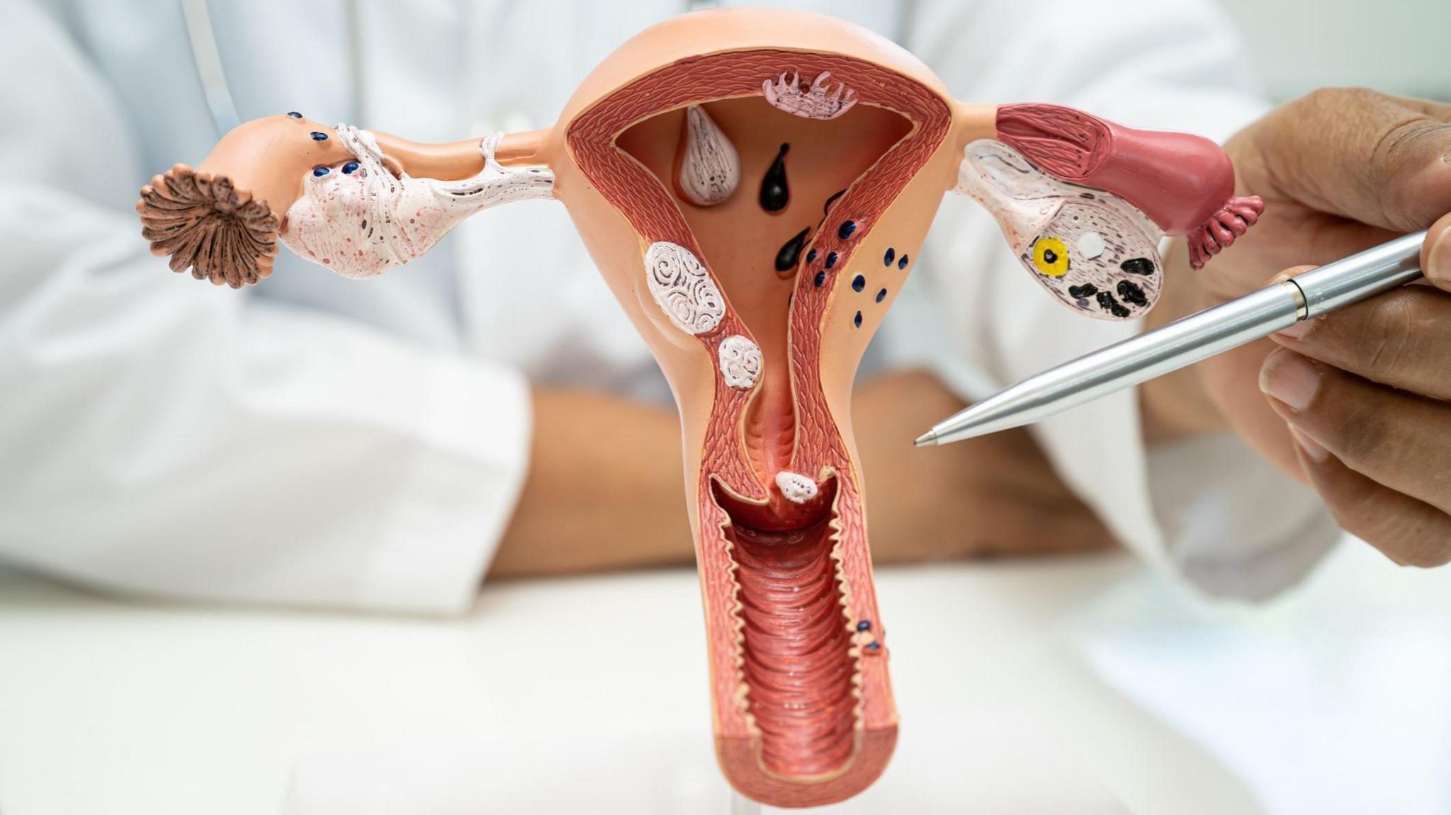 A doctor demonstrating on a plastic anatomical model where the cervix is in the female reproductive system.