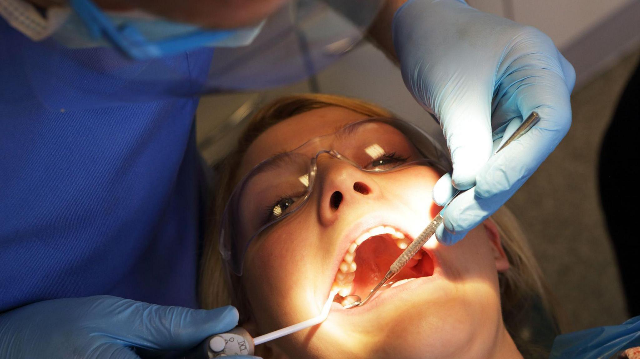 A woman lying on a dentists' chair with her mouth open - a dentist is examining her teeth