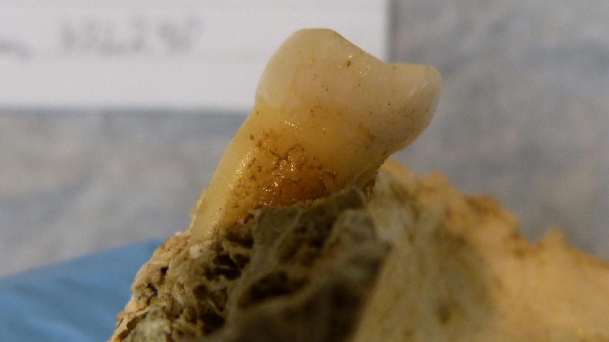 4,000 year old tooth