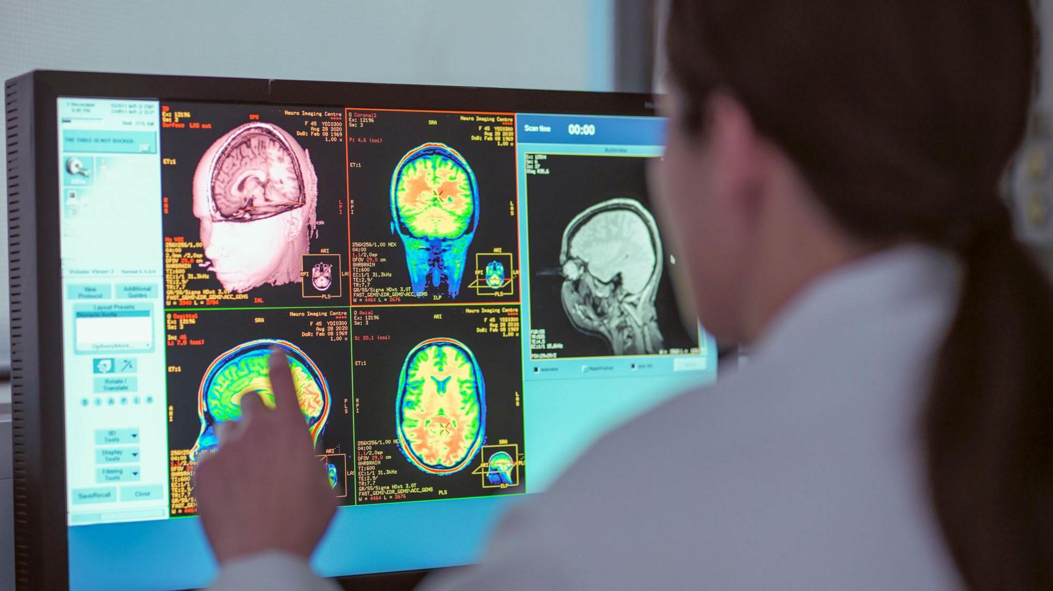 Female doctor looking at MRI scanner monitor 