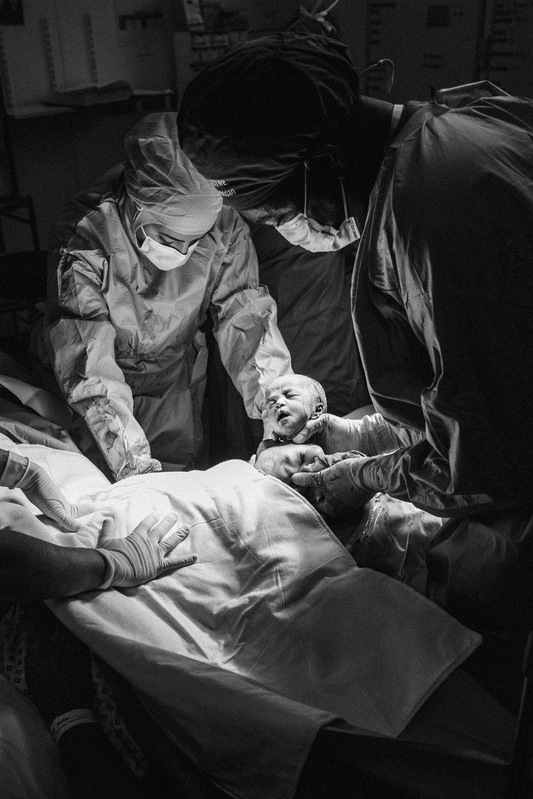 A photo capturing the moment of birth during a C-section. Two healthcare workers in surgical scrubs and masks assist as the newborn is carefully lifted. The image is lit by surgical lights.