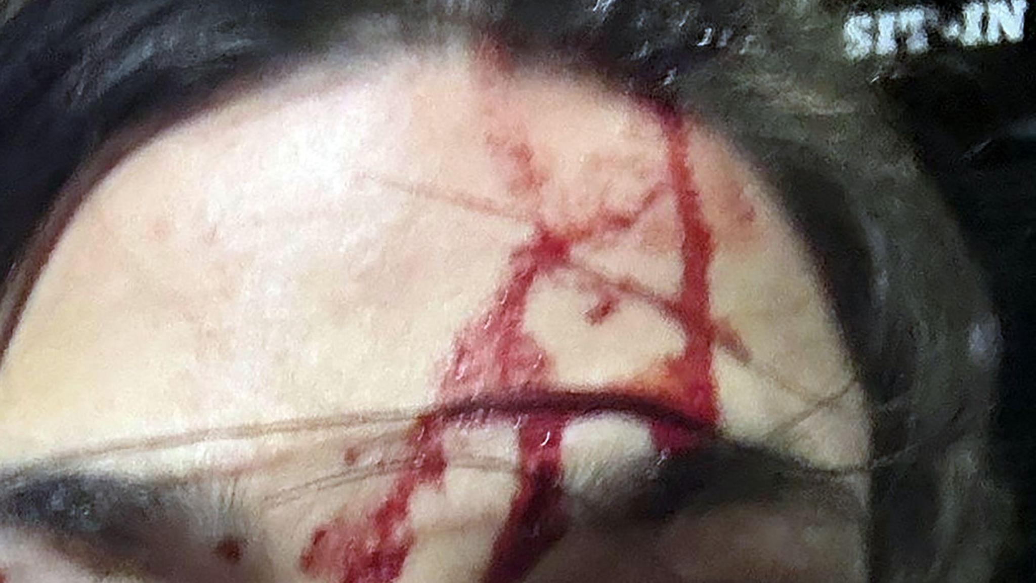 A close up of a police officer's head following an assault. The head is covered in blood the officer has black hair