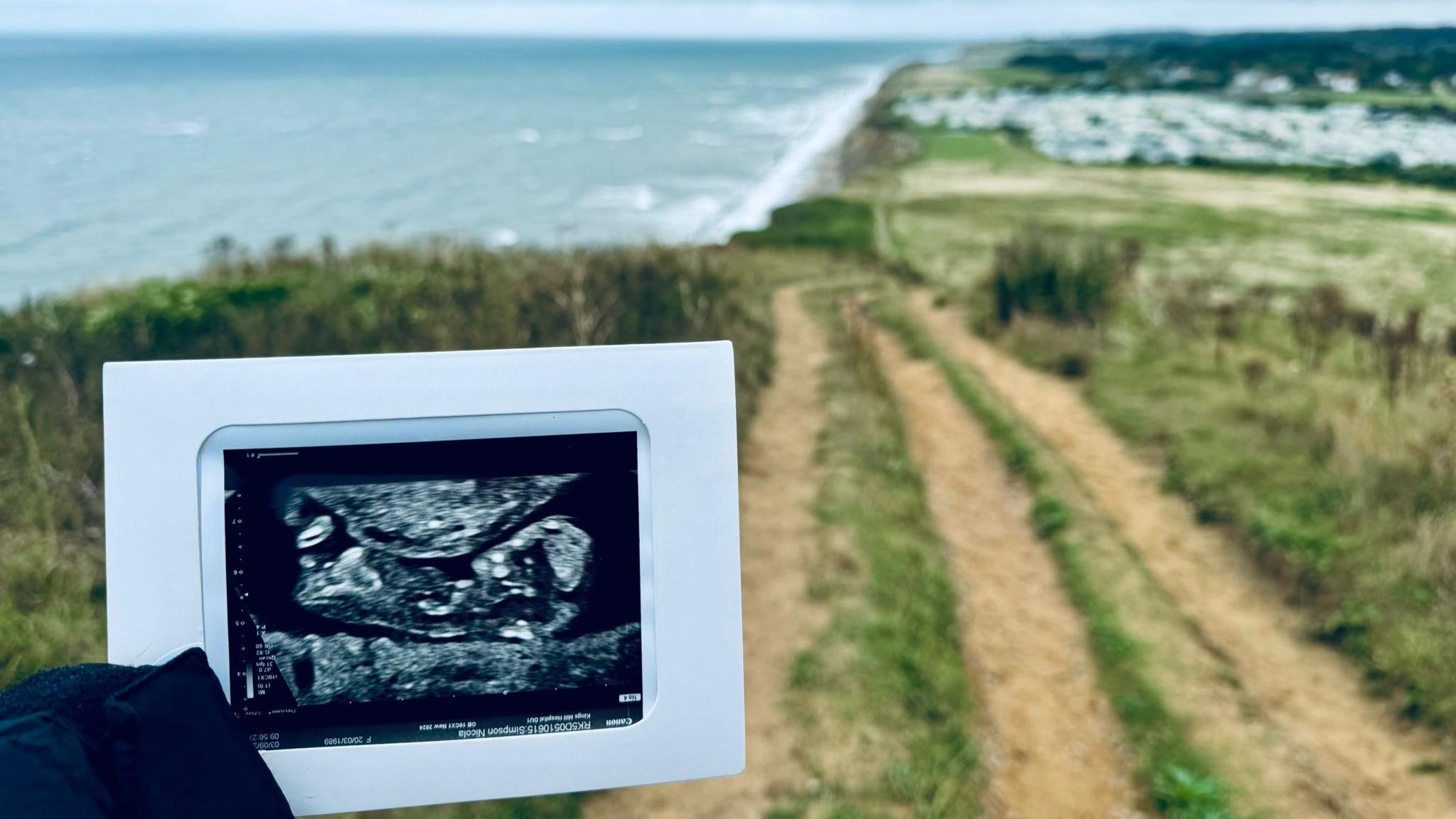 A photo of a baby scan with the sea in the background 