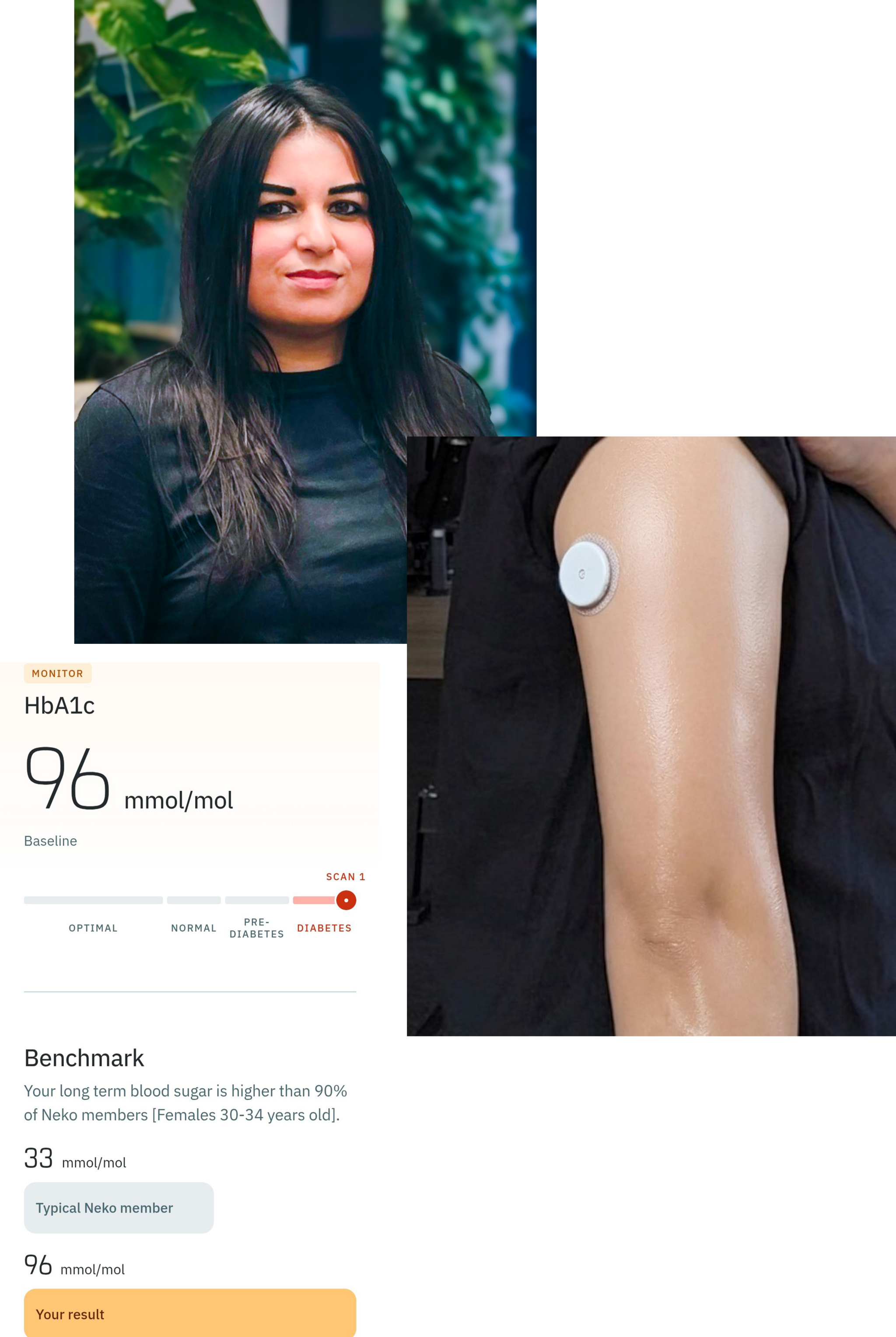 A portrait image of Mehvish, a picture of her blood suger results and one of her arm with a glusocs monitor attached.