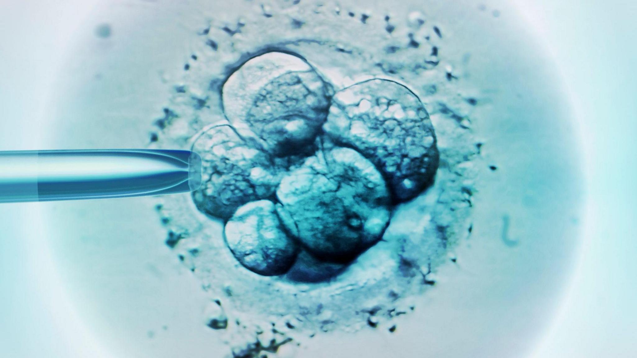 Cells under a microscope