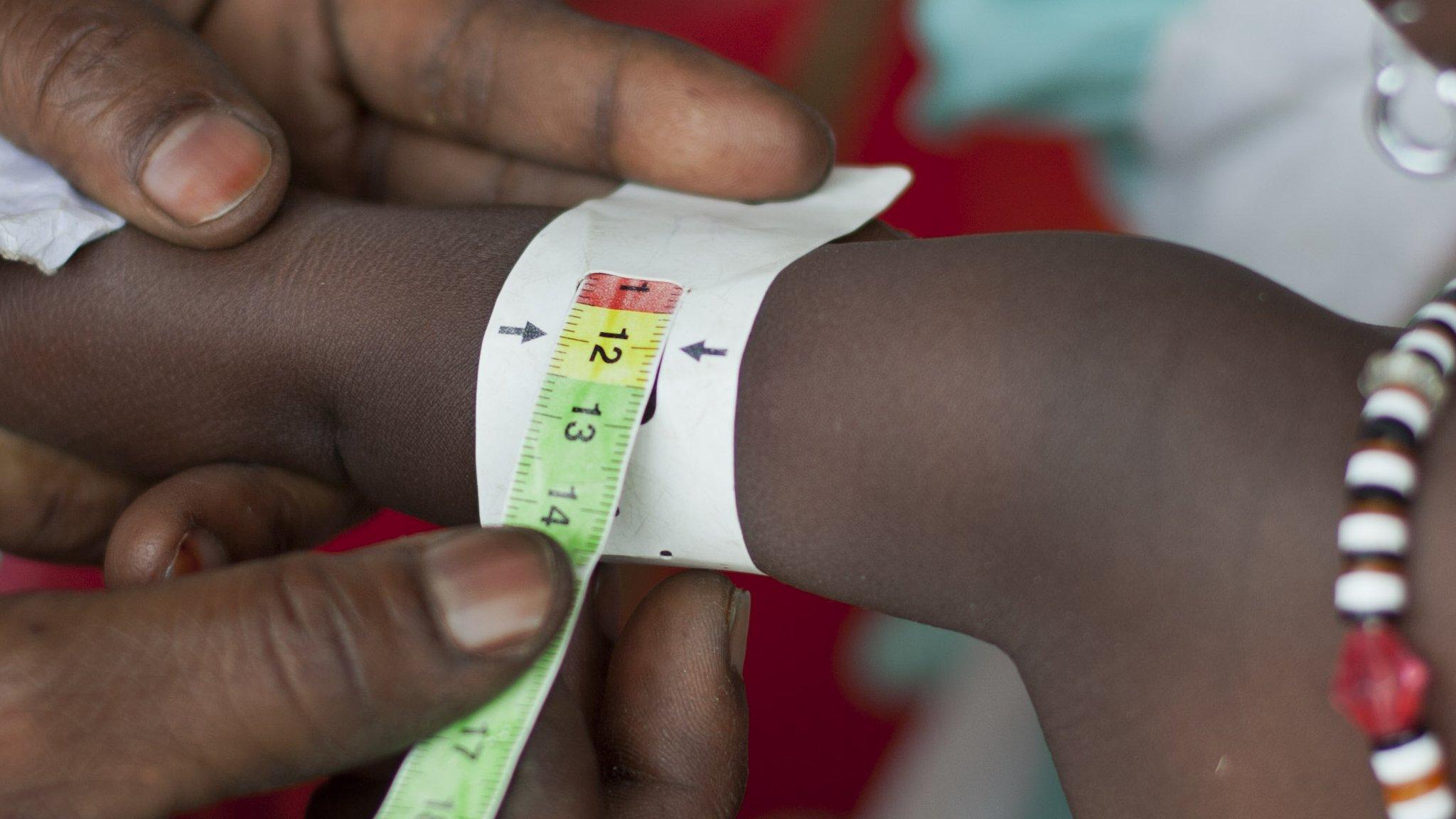 Child's arm being measured