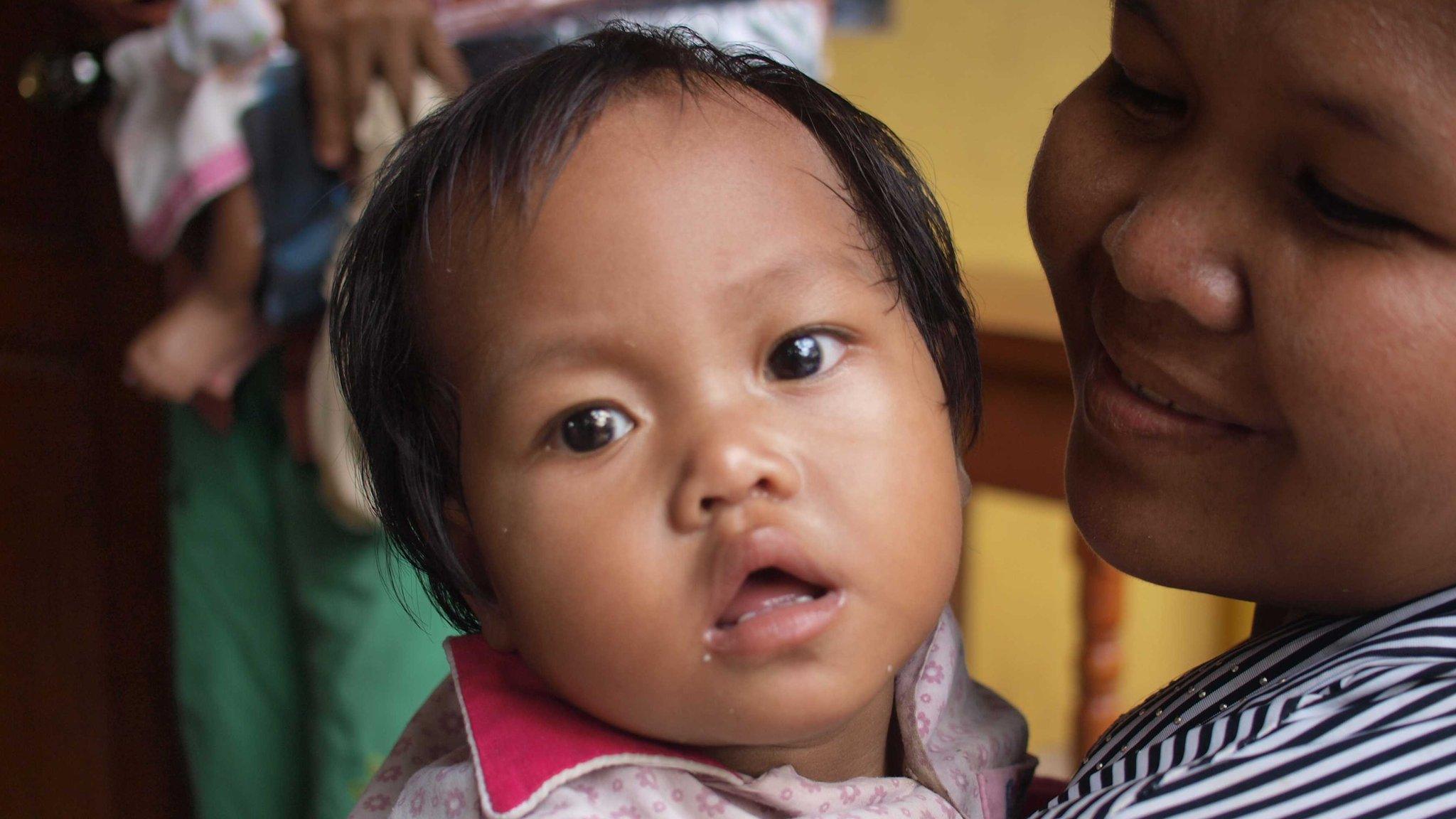 A patient at the Children's Fund Clinic on the outskirts of Phnom Penh