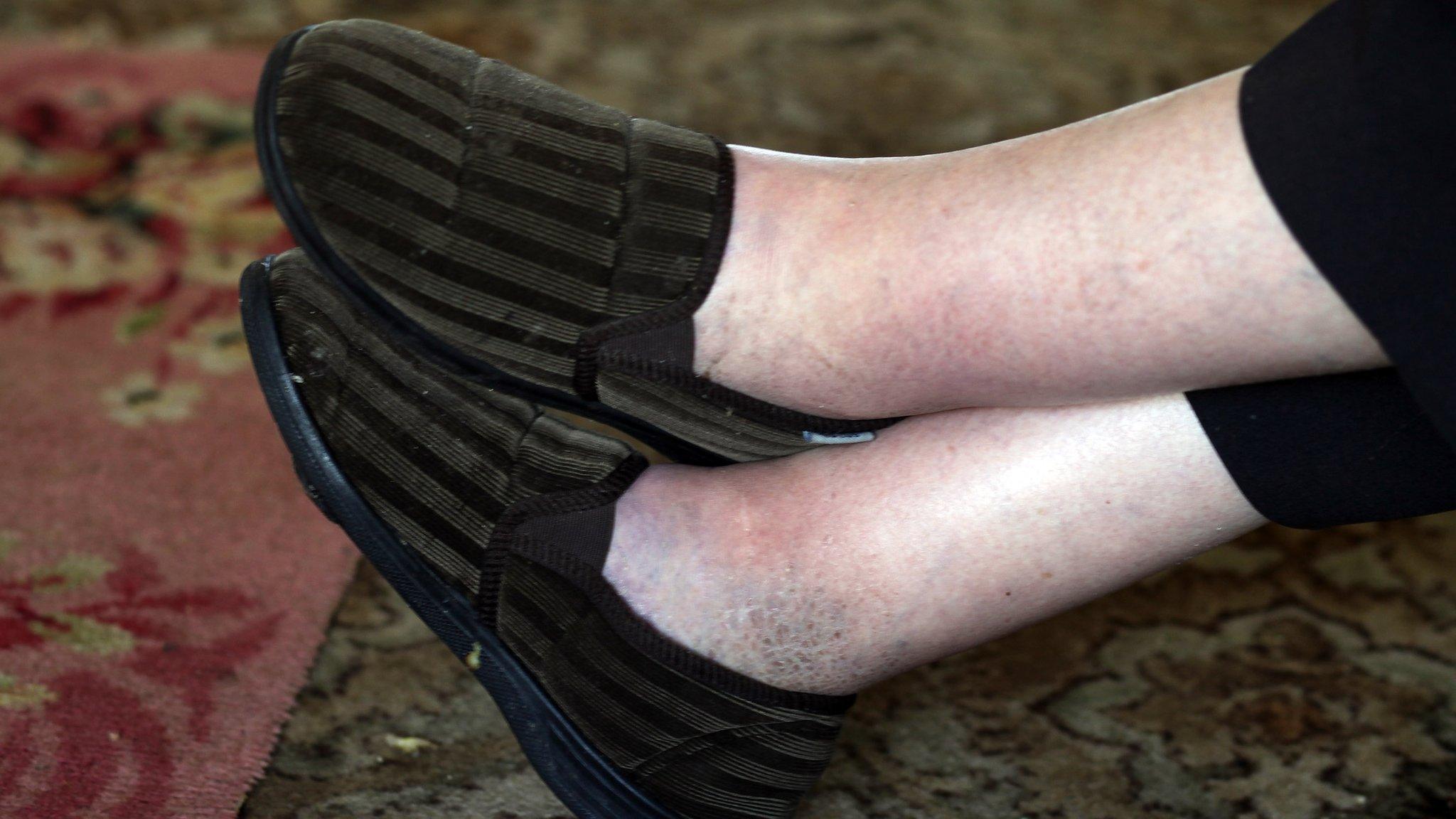 A pair of slippers