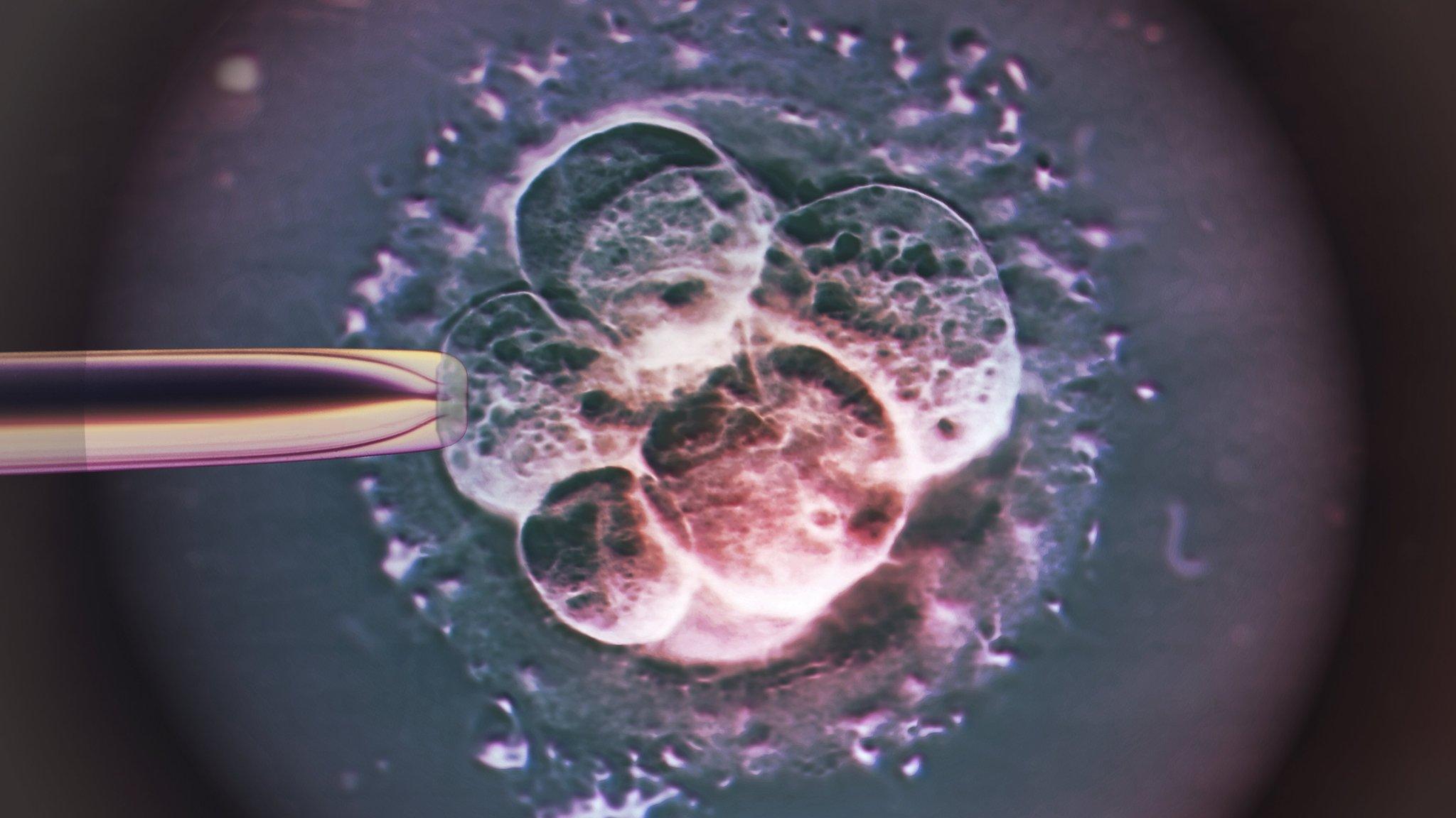 IVF