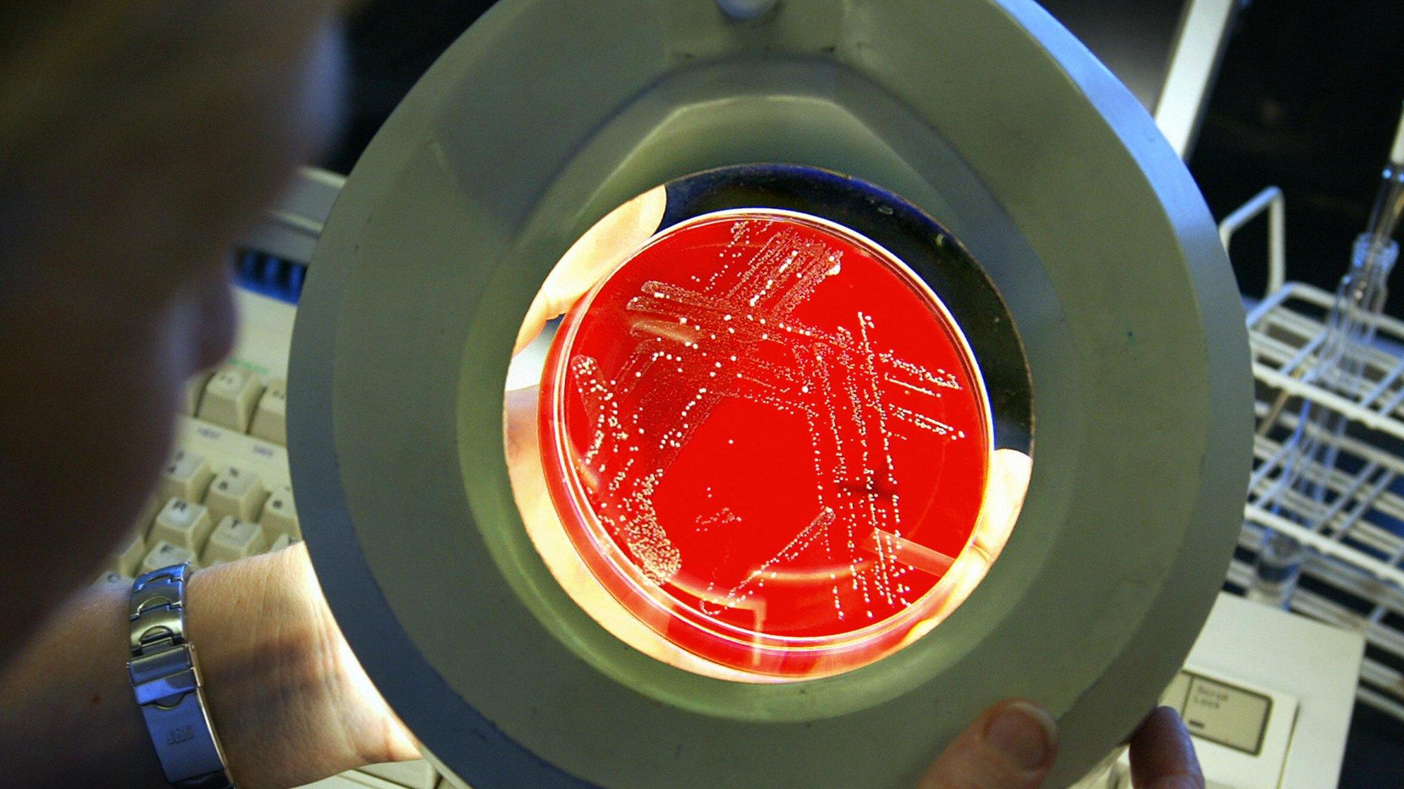 A scientist inspects an antibiotic-resistant superbug