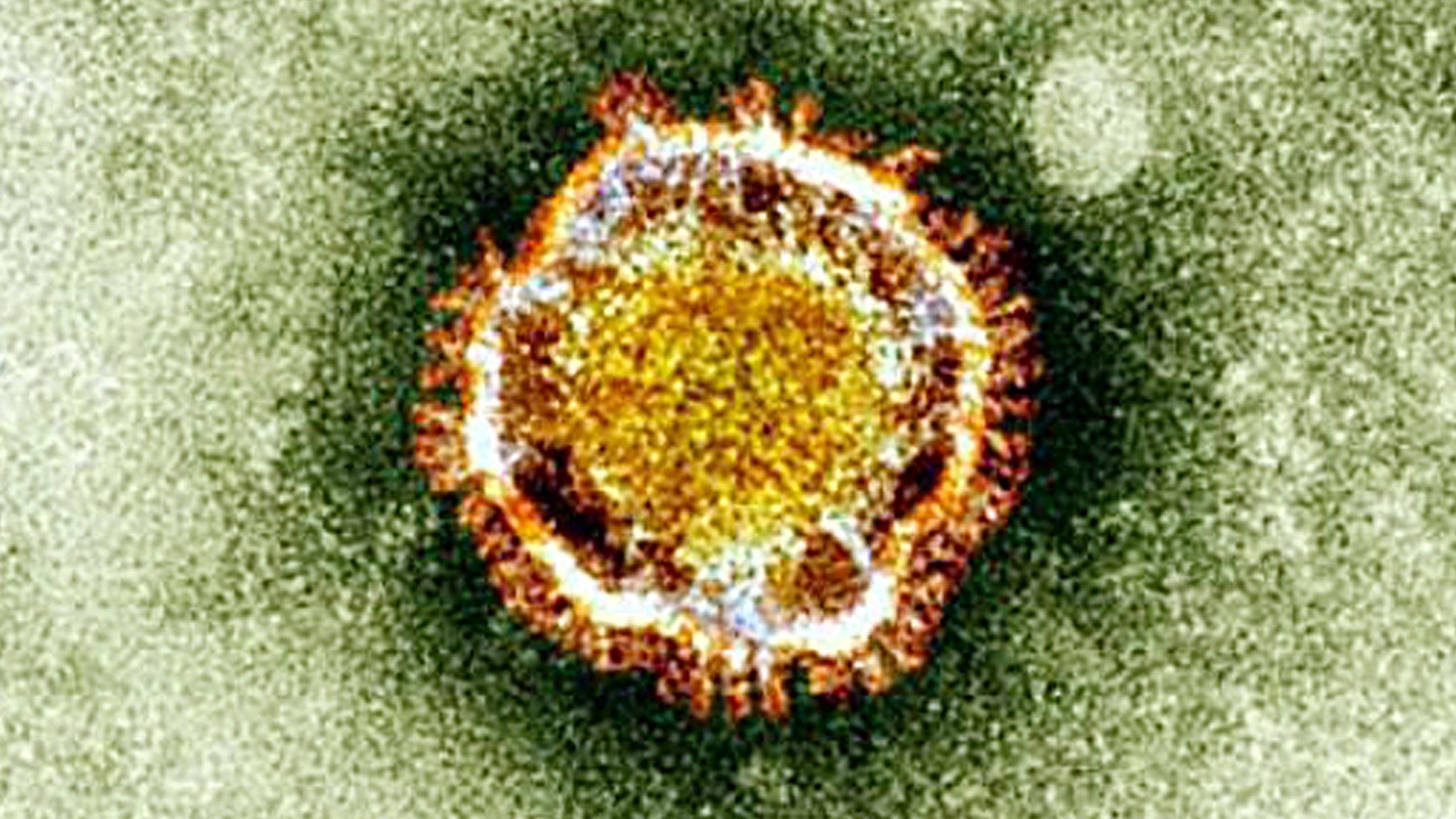 Virus