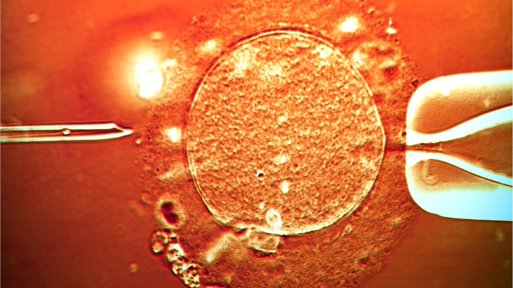 IVF