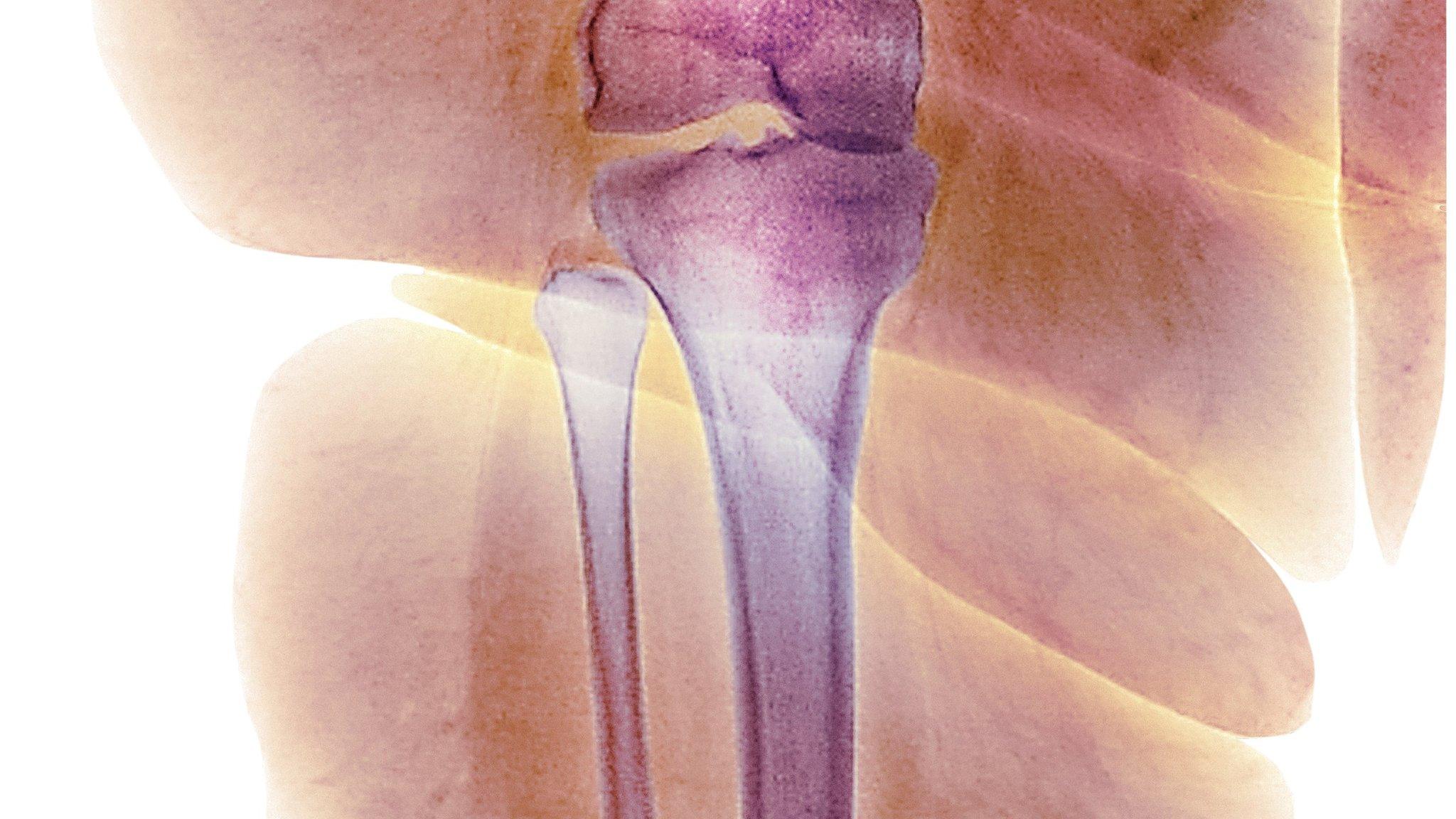 x-ray of leg