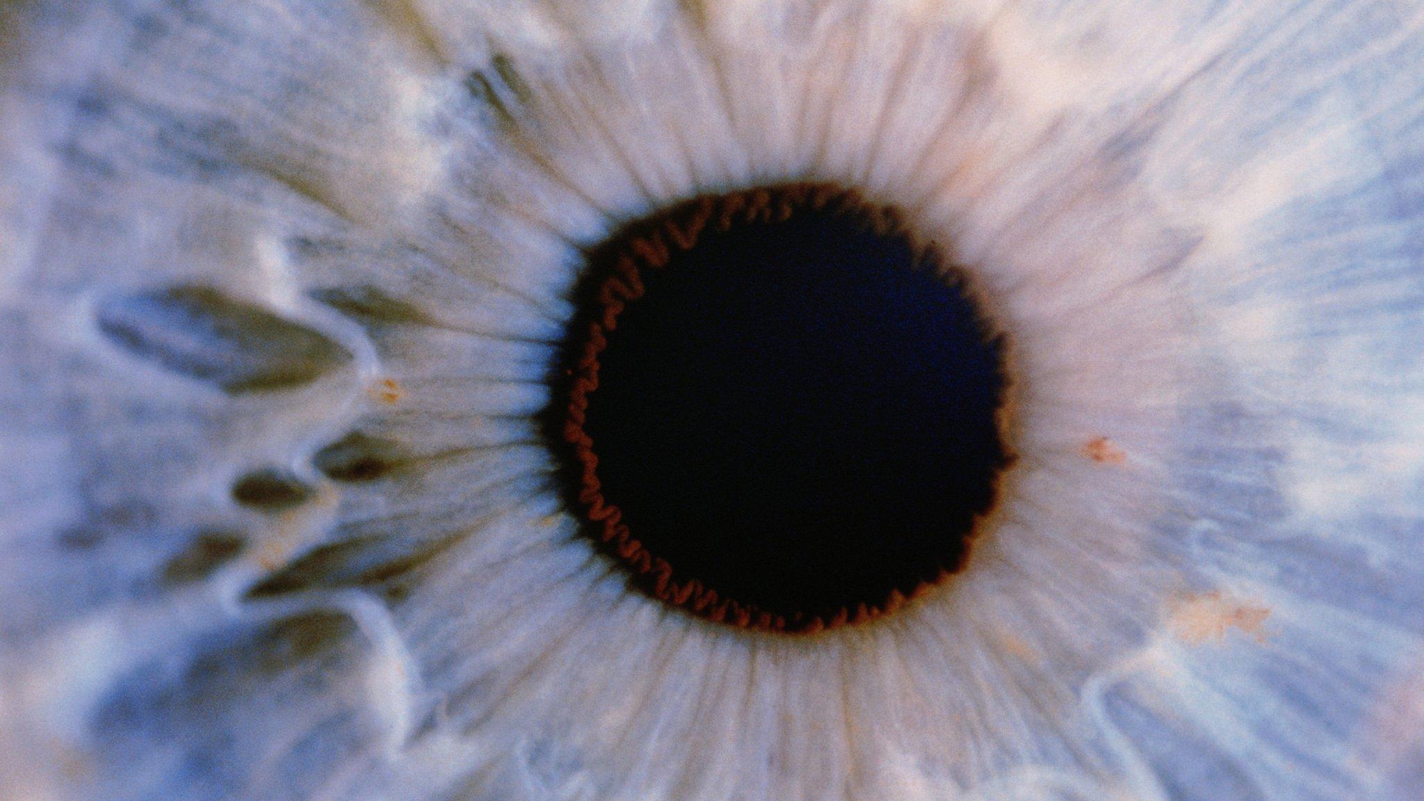 Eye