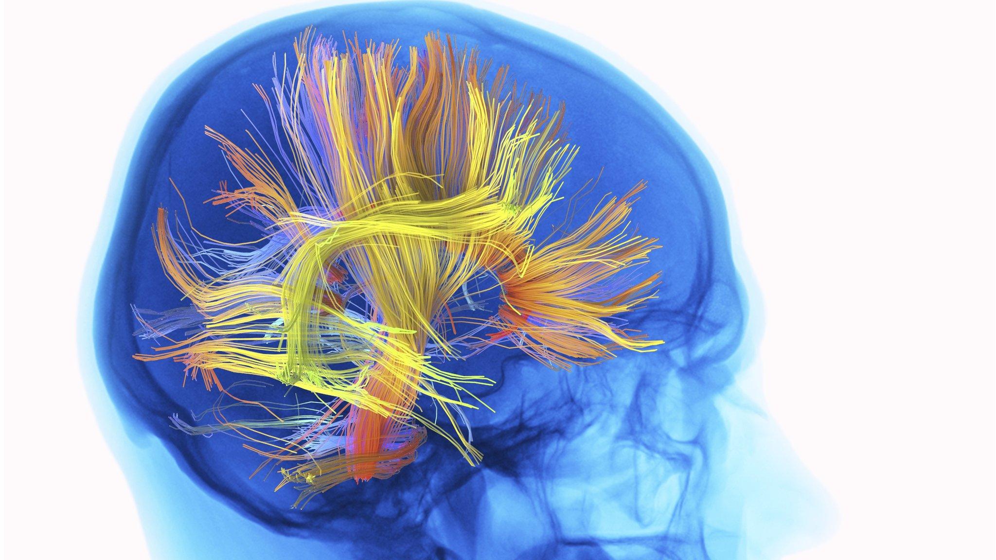 Brain