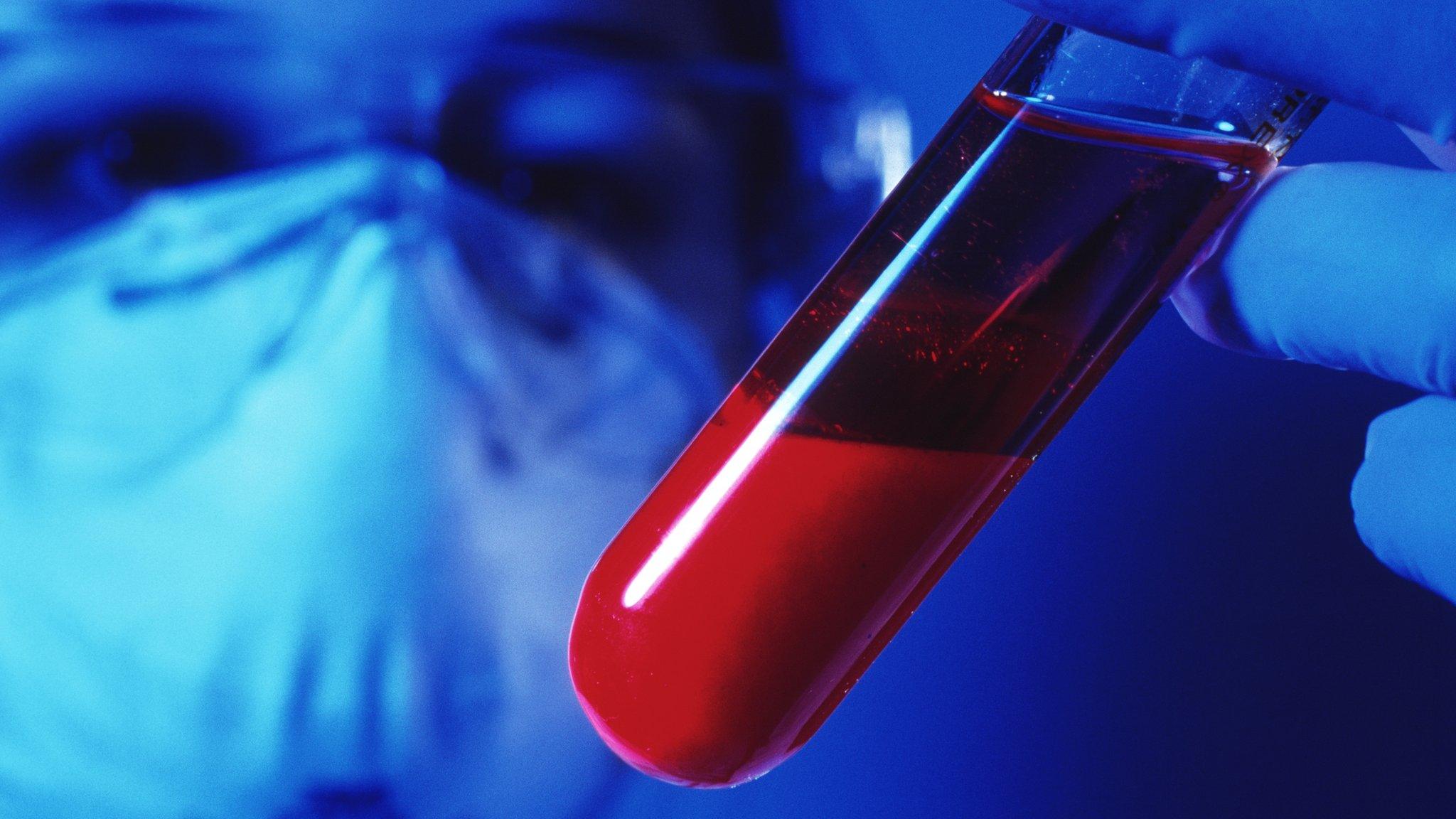 Blood test
