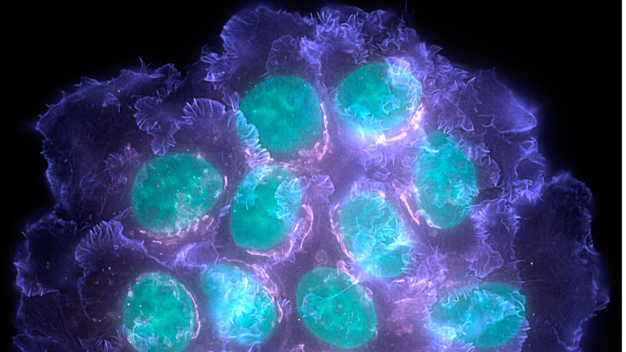 Cancer cells