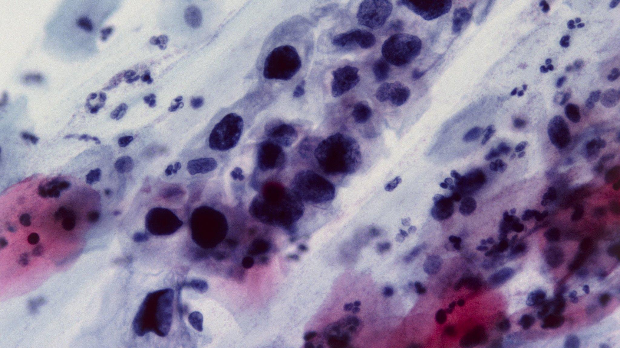 Smear test slide