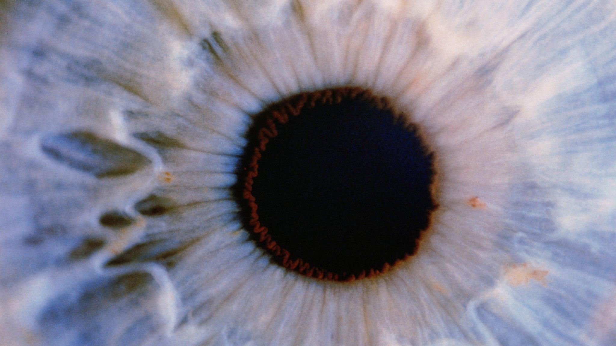 Human eye