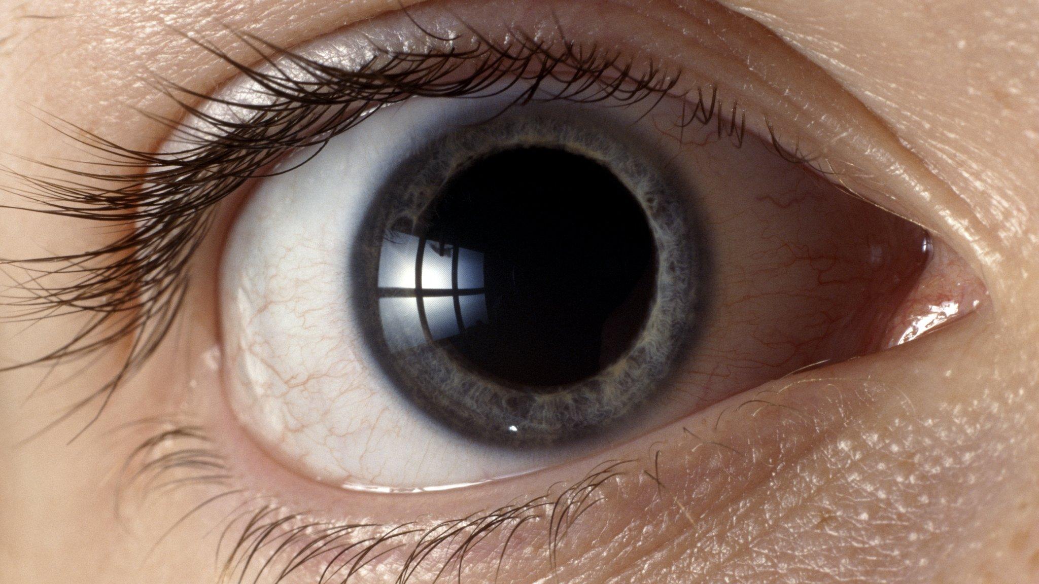 Eye