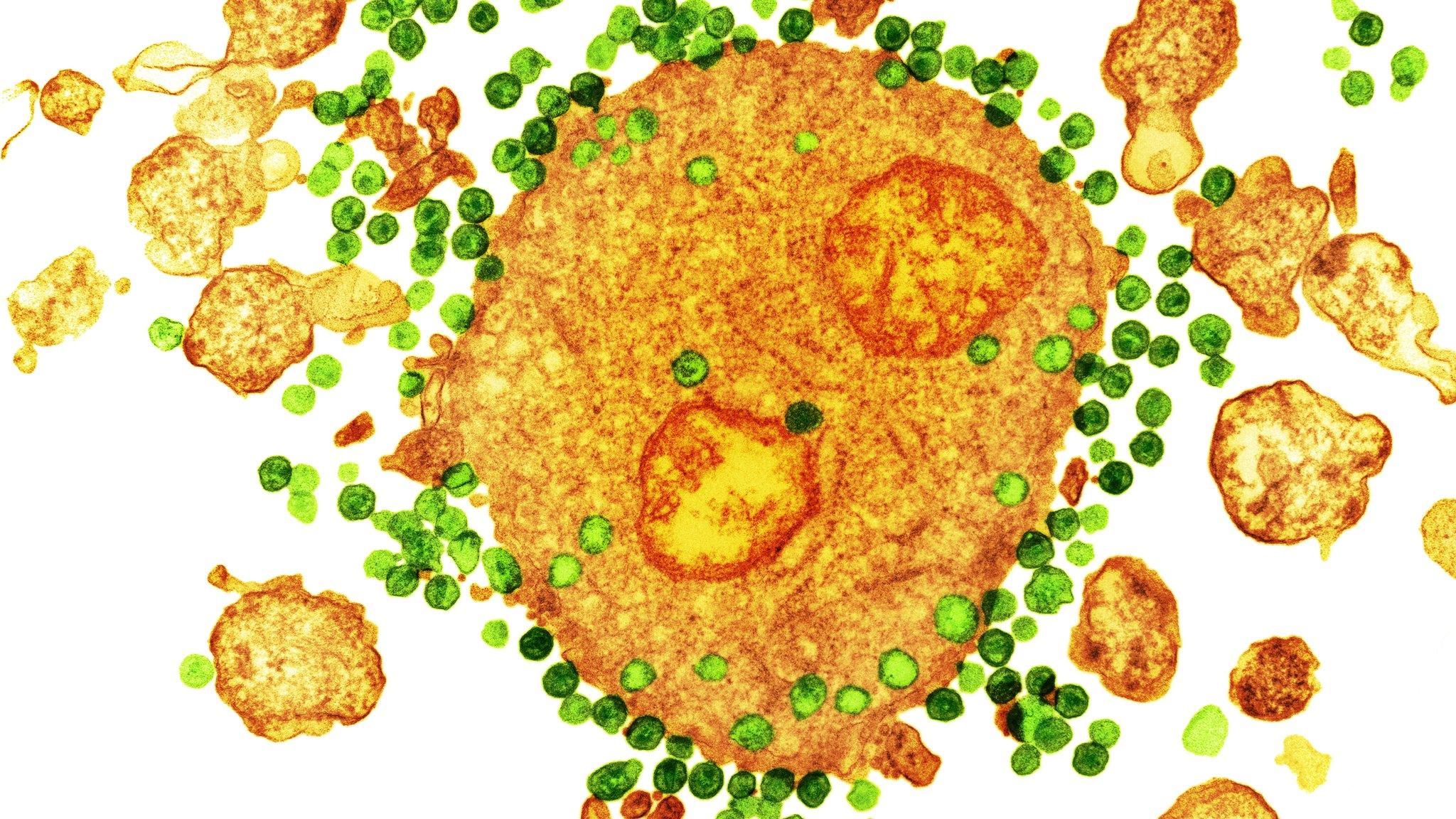 HIV