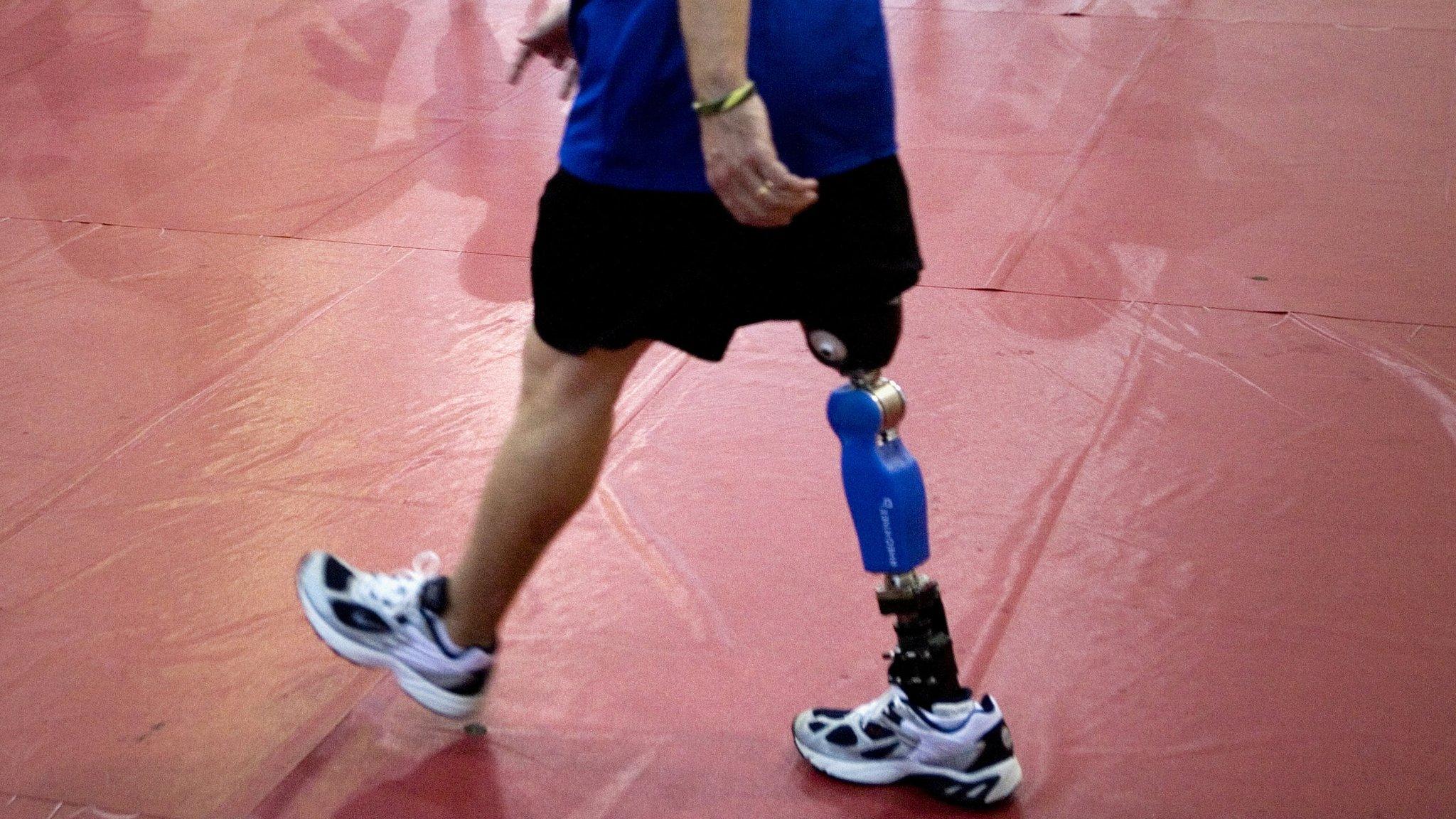 Veteran with prosthetic leg