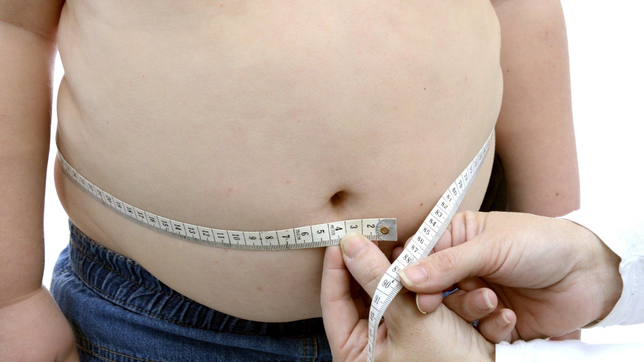 An obese boy