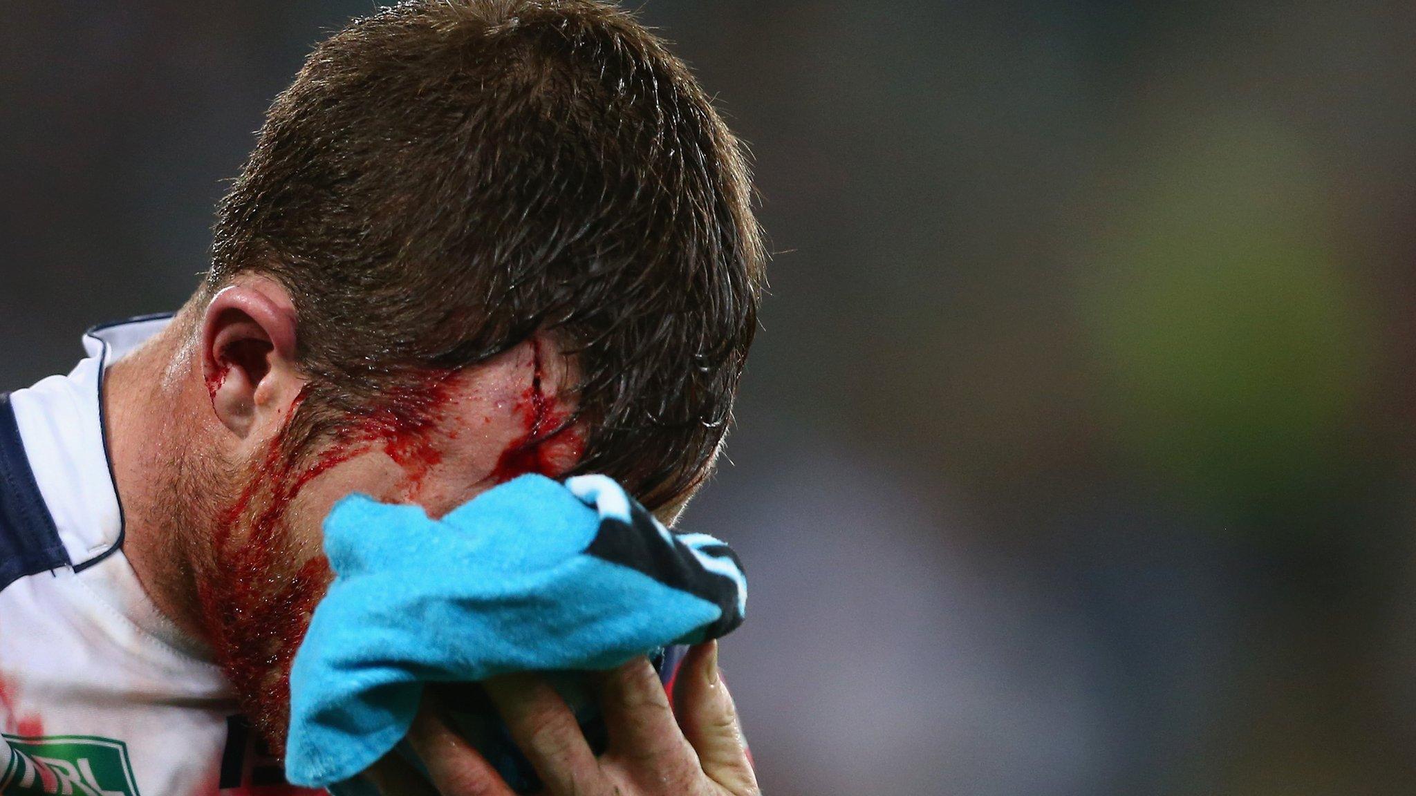 Concussion has become a major talking point in rugby