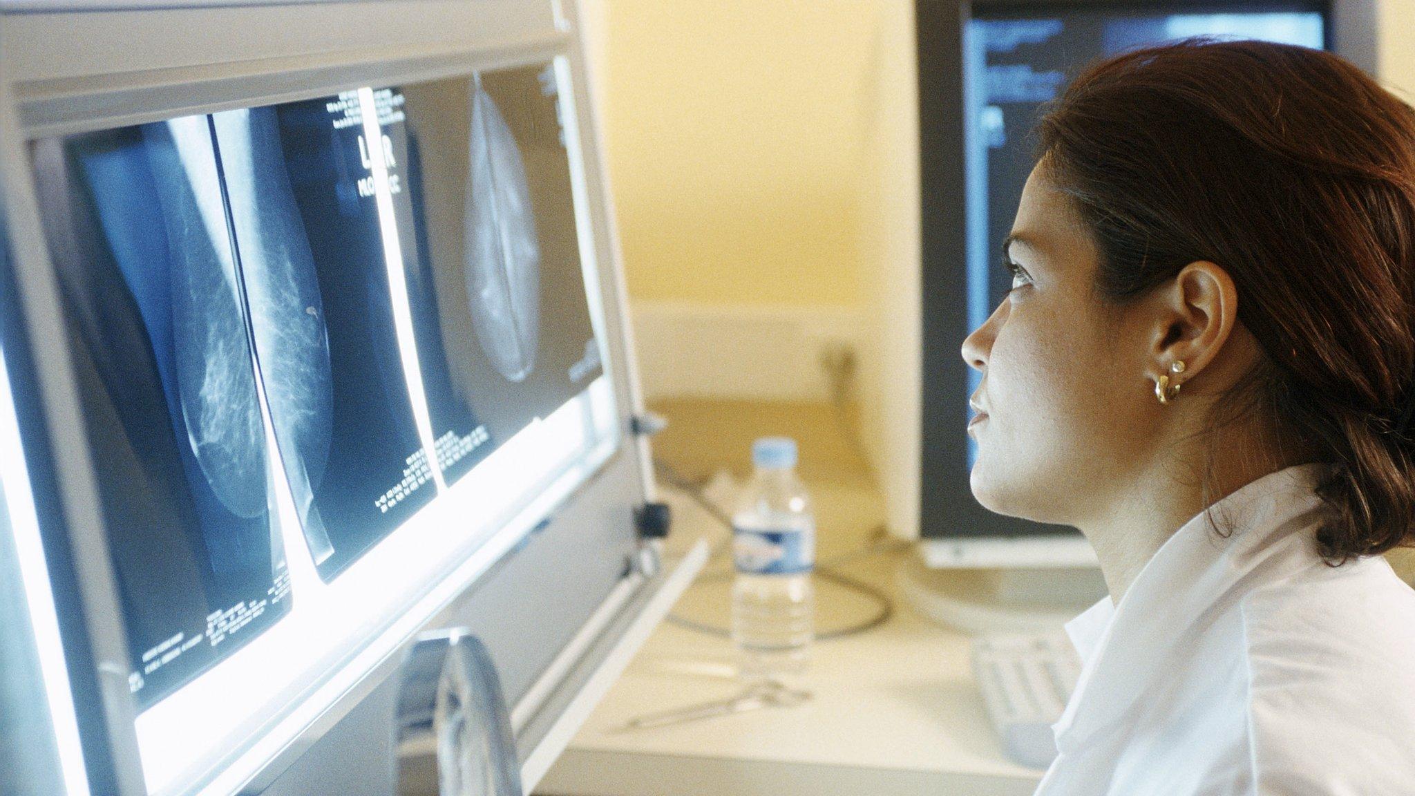 Doctor examines breast X-ray