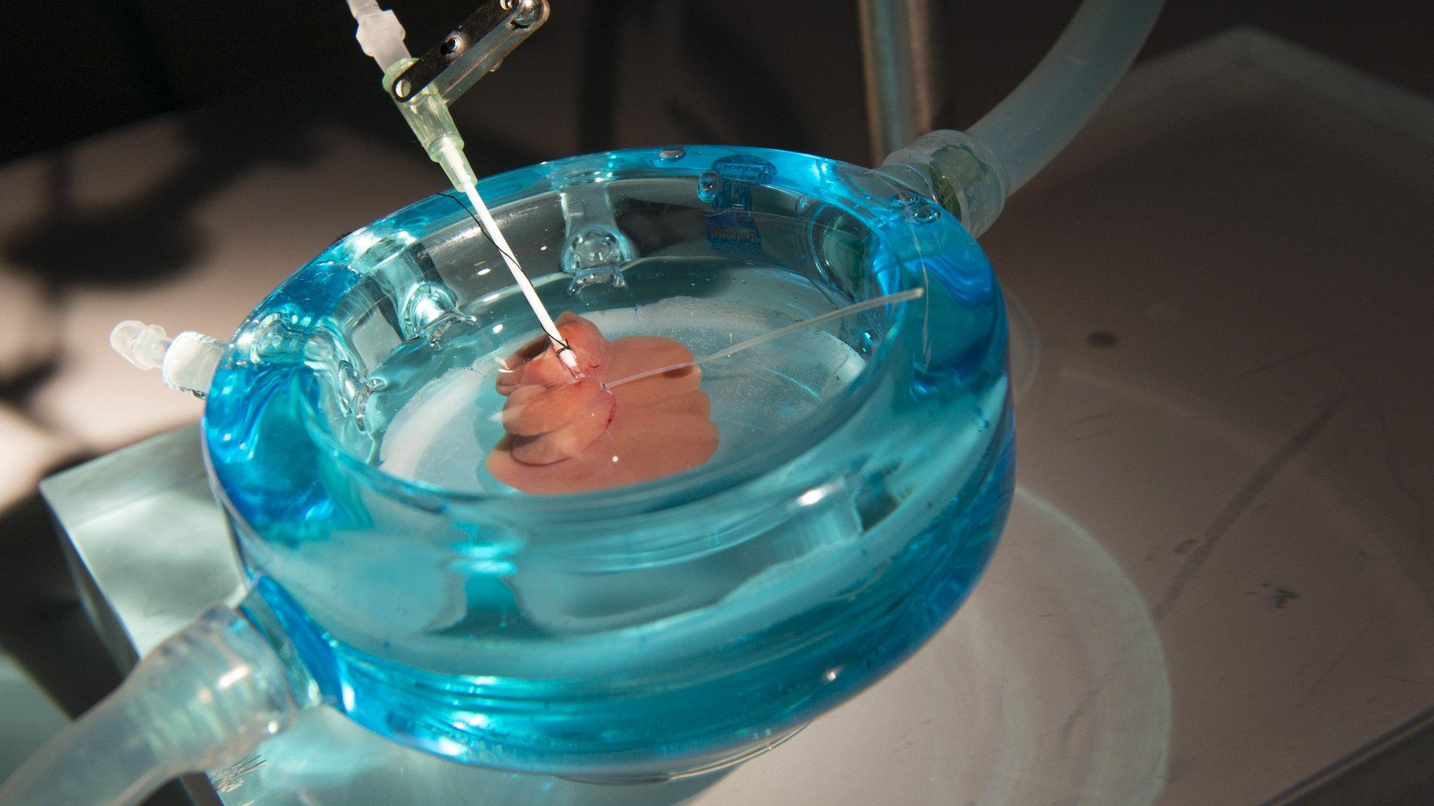 A 'supercooled' rat liver