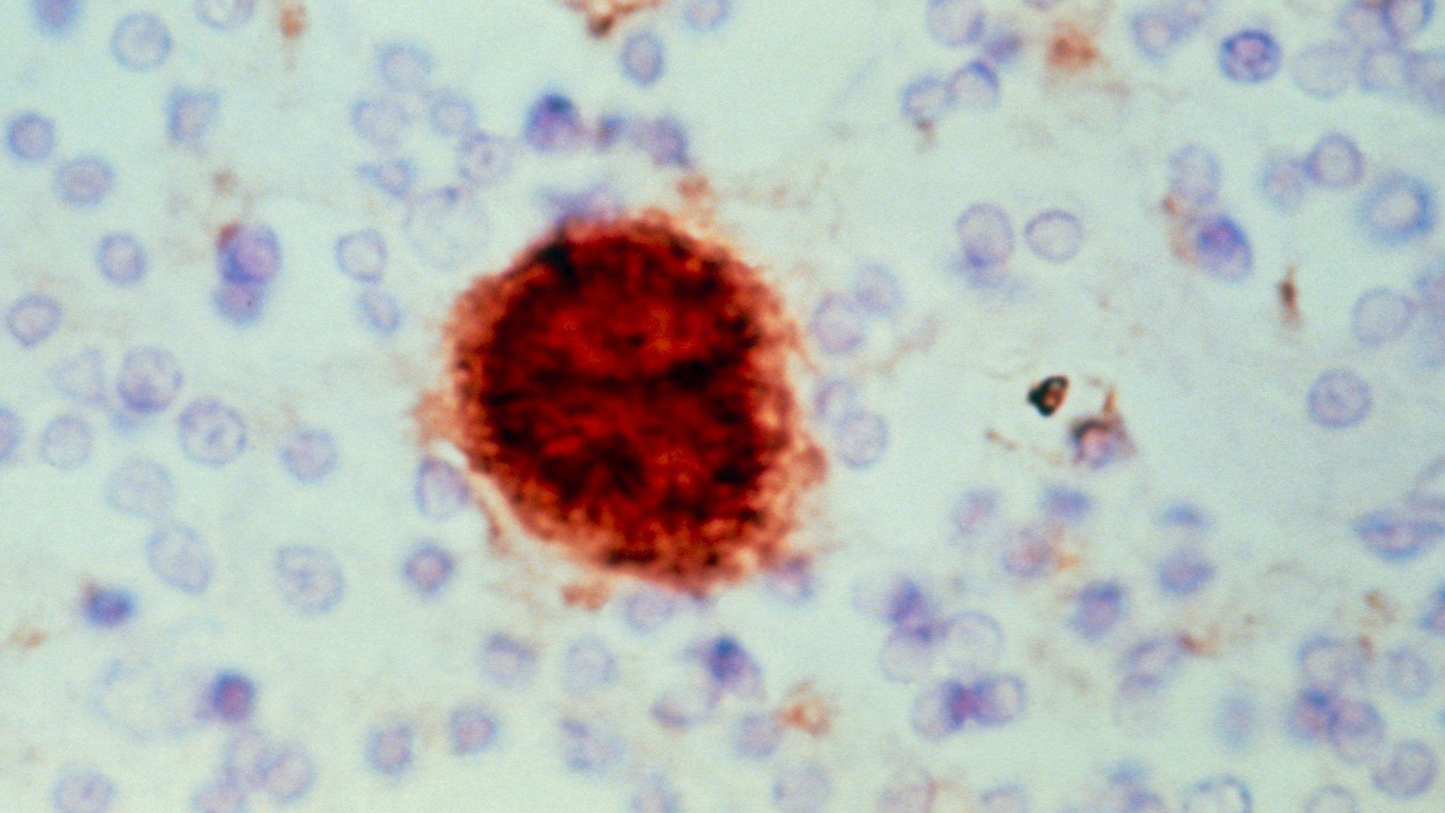 Section of brain