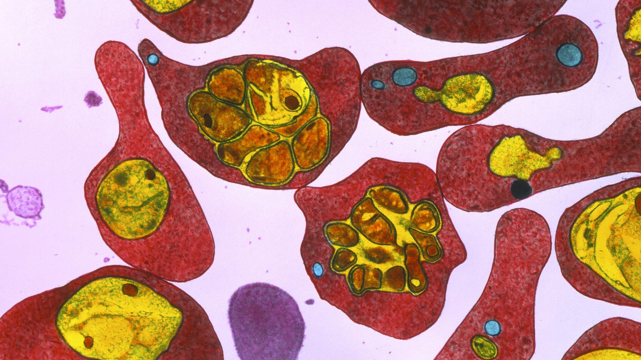 Malaria infected red blood cells