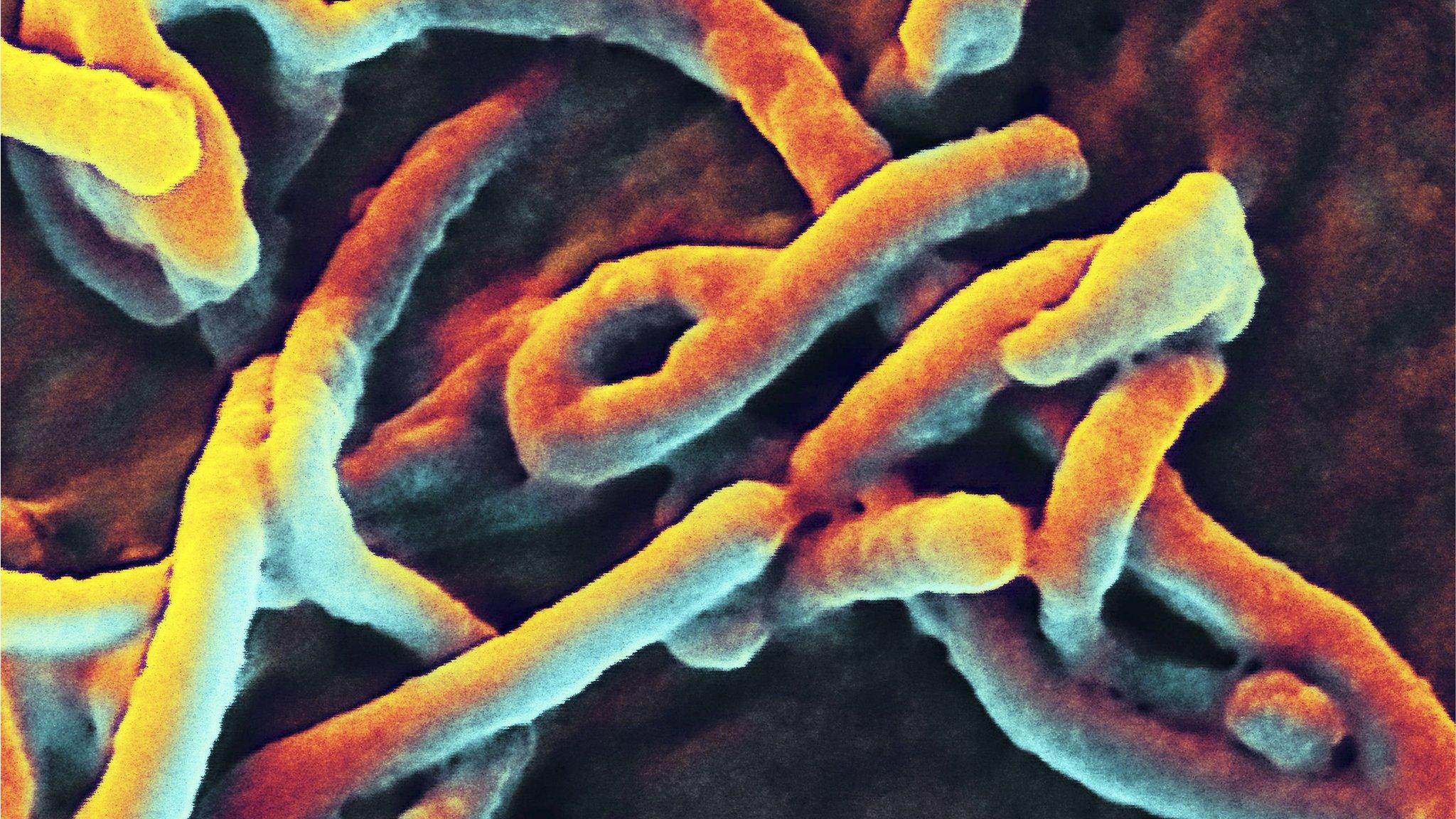 Ebola virus