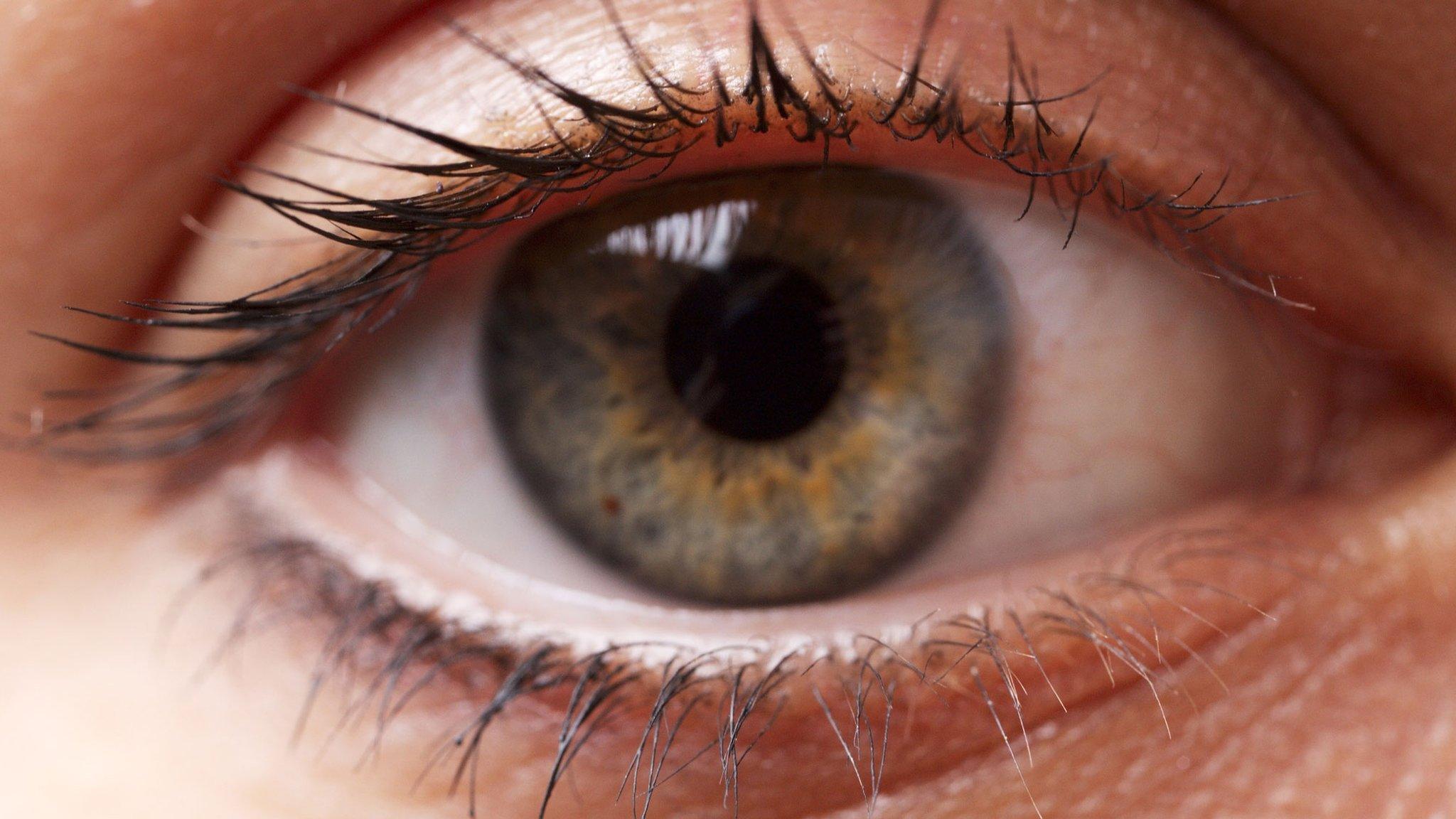 Eye