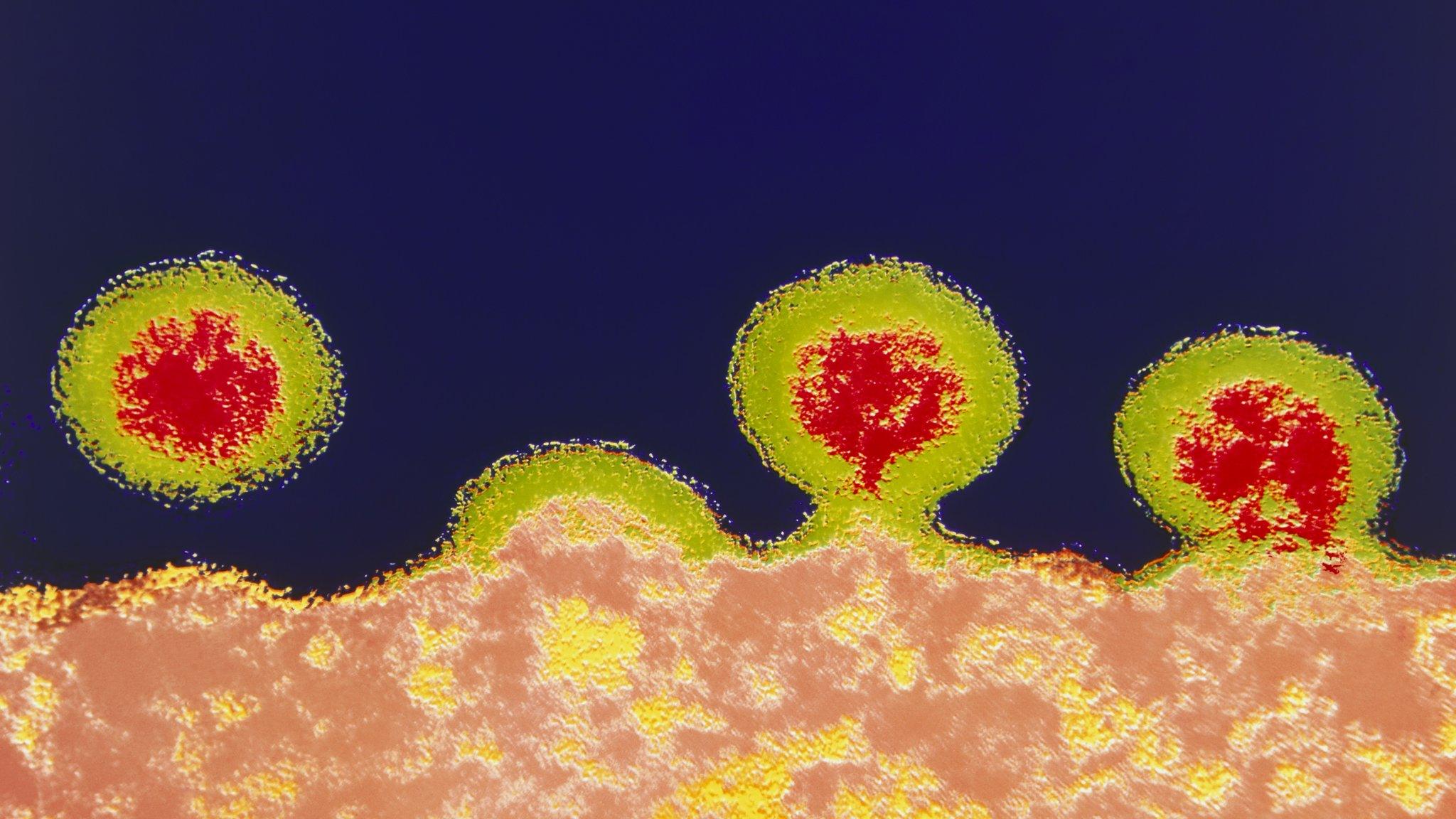 HIV