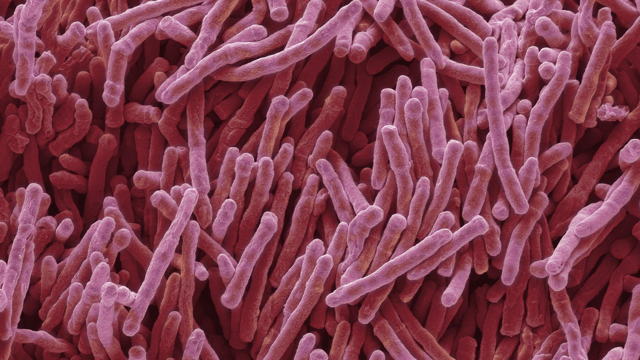 Bacteria
