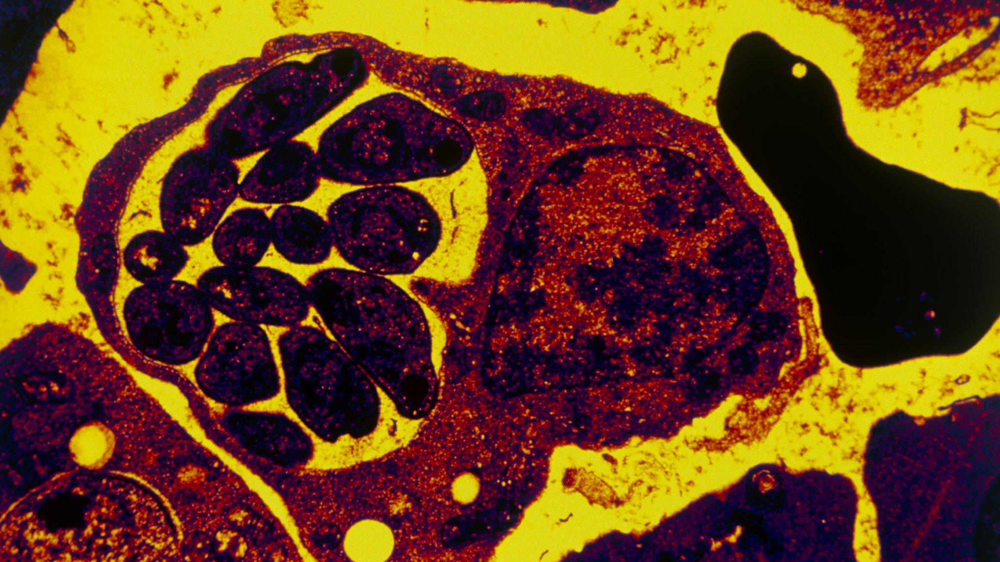 Red blood cell with malaria parasite