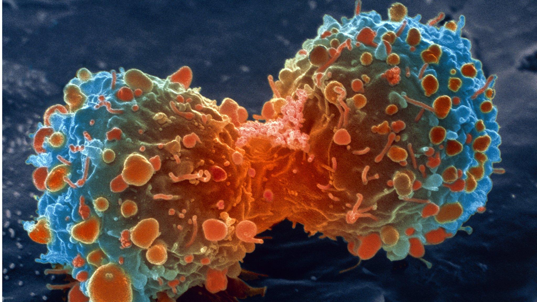 Lung cancer