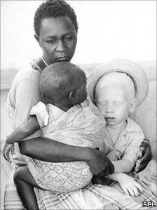 A woman with her two children, one of which is albino. Tanzania.