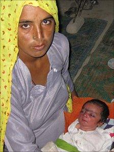 Allah Rakhi and her baby, Samina, now much healthier