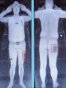 A computer screen showing the results of a full body scan