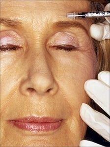 Woman have botox